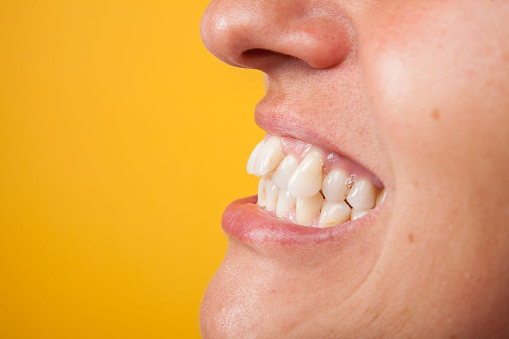 歯並びの悩み、矯正治療で解消しませんか。