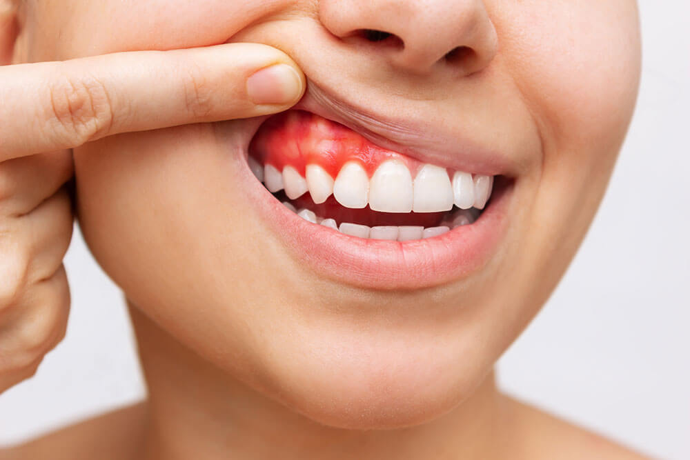 歯ぐきについて こんな悩みありませんか？
